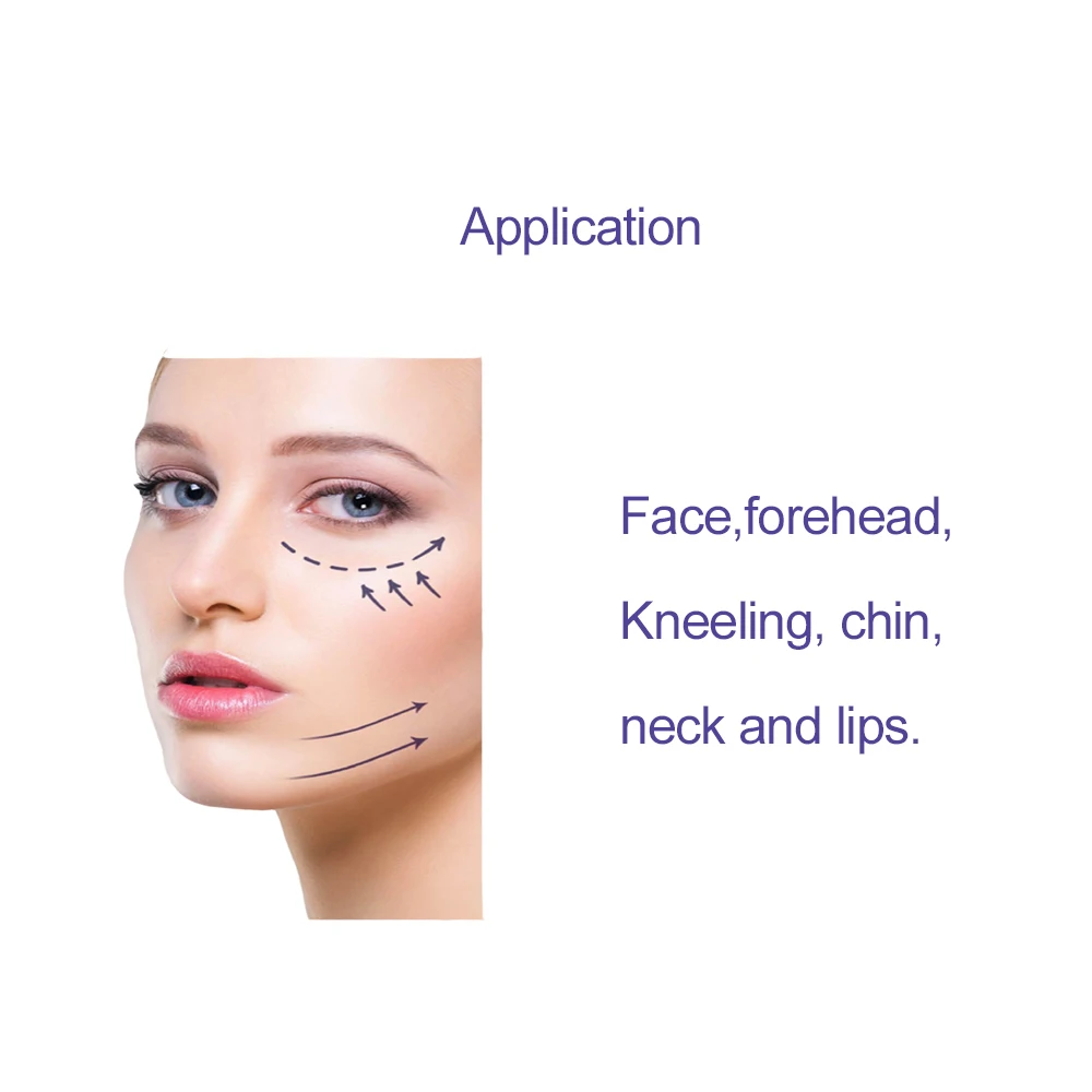 Wholesale plastic polydioxanone sutures lifting lifting v line mono 26g 90mm 60mm pdo thread