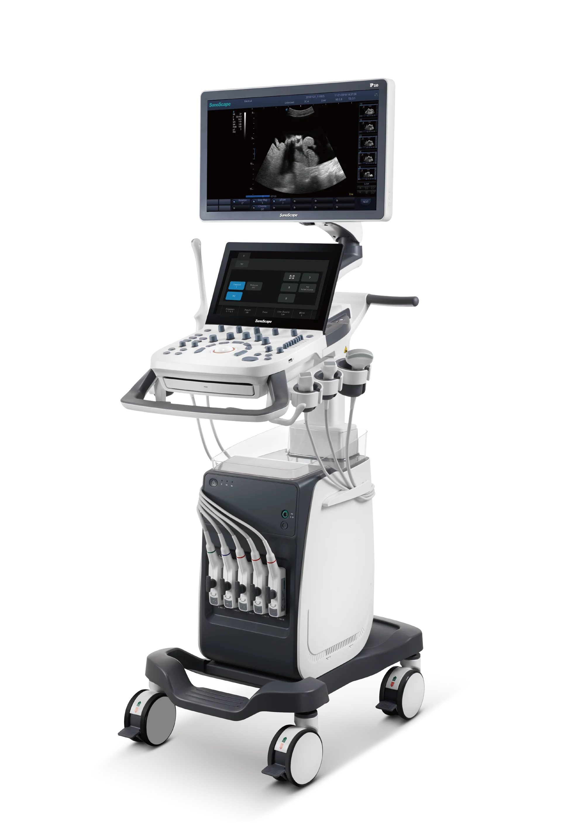 The good price medical machine sonoscape P9 digital color doppler diagnostic ultrasound  with trolley