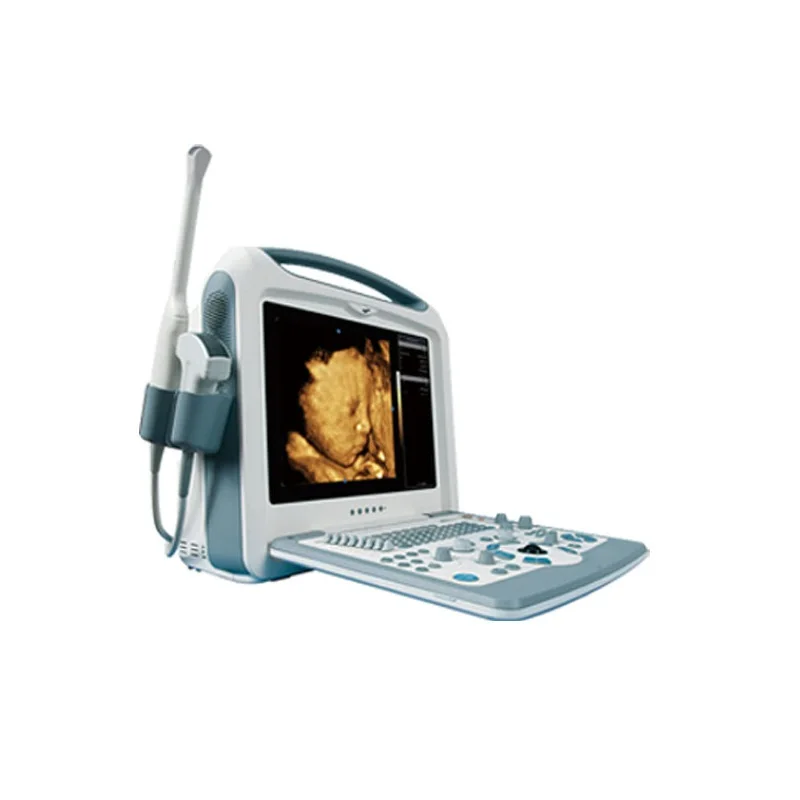 High Accuracy Factory price   CE Approved  medical  Ultrasound Scanner