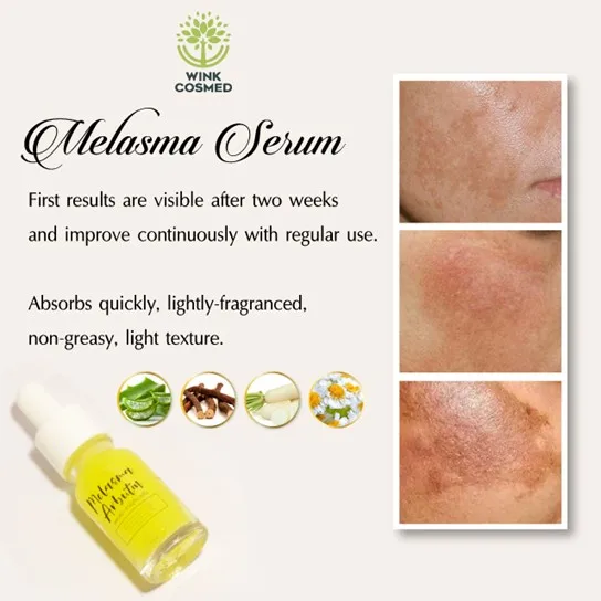 Private Label OEM ODM Melasma Serum Hydrating Essence Reduce Fine Line Pigmentation Correctors Smoothing Moisturizing Facial