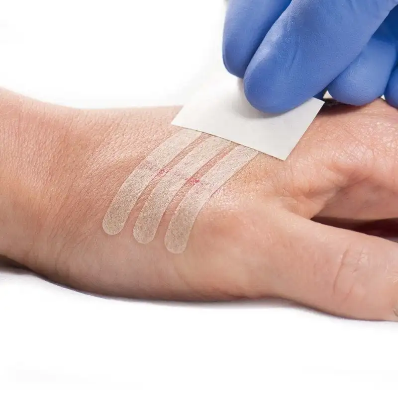 High Quality Industry Trending Reinforced Adhesive Skin Wound Closure Waterproof Steri Strips 1/2 inch x 2 inch (12mm x 50mm)