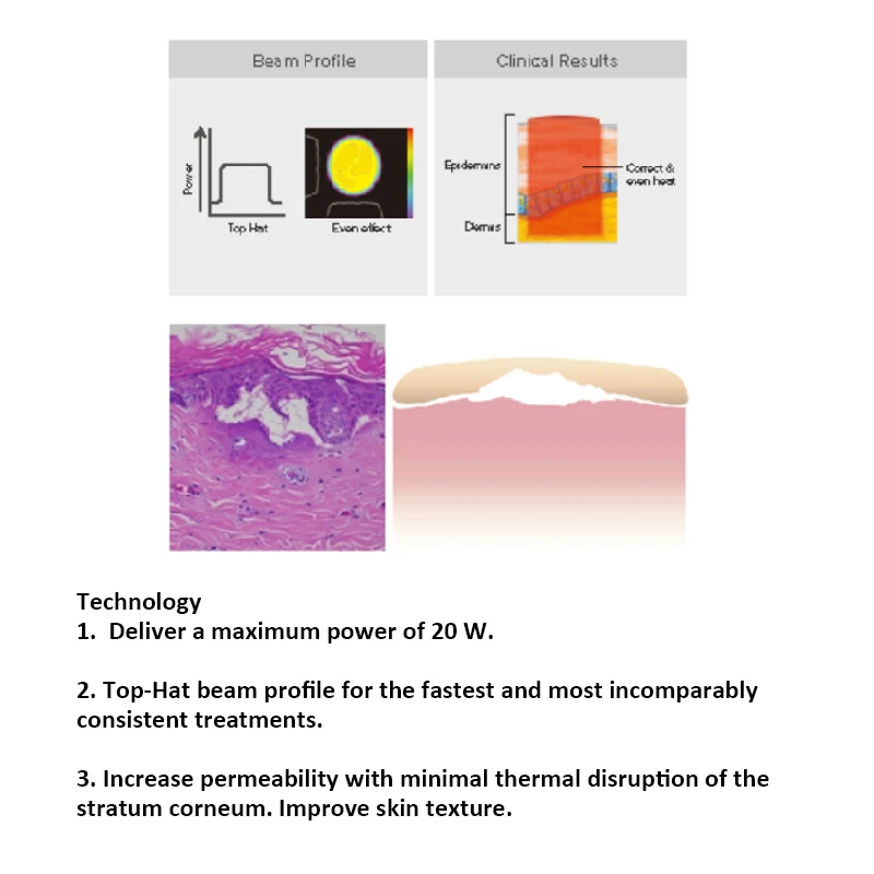 2024 new Rapid treatment 200 μm beam diameter nonablative factional For laser treatment of wrinkles1927nm thulium laser machine