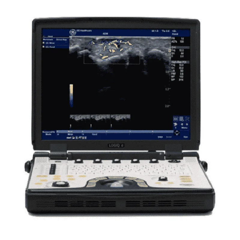New GE Logiq E NextGen Portable Ultrasound