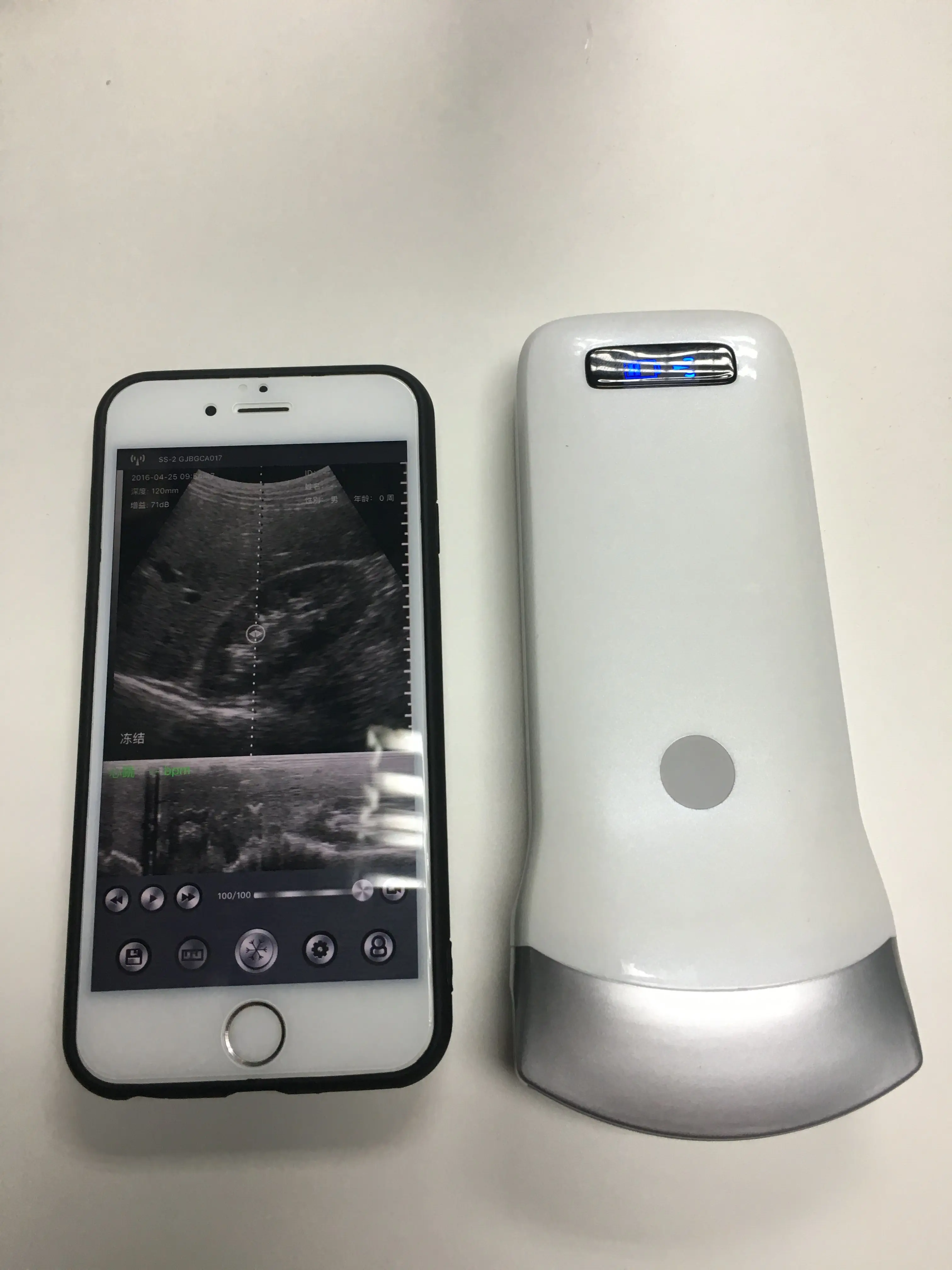 wireless android/ios convex array usb ultrasound probe ultrasound scanner pocket ultrasound for sale price