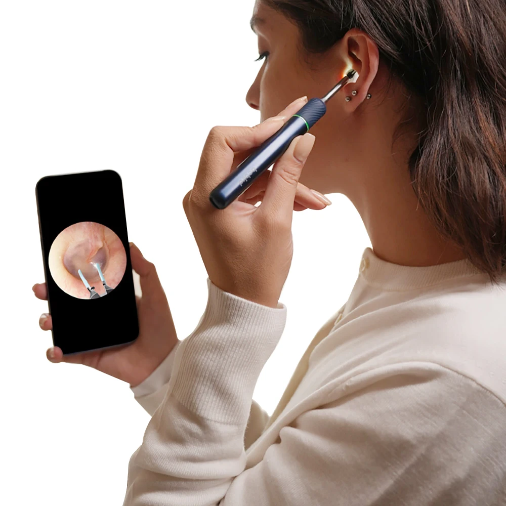 Unique gift Bebird 3 in 1 Note 5 pro robotic arm tweezers WiFi wireless ear cleaner with light