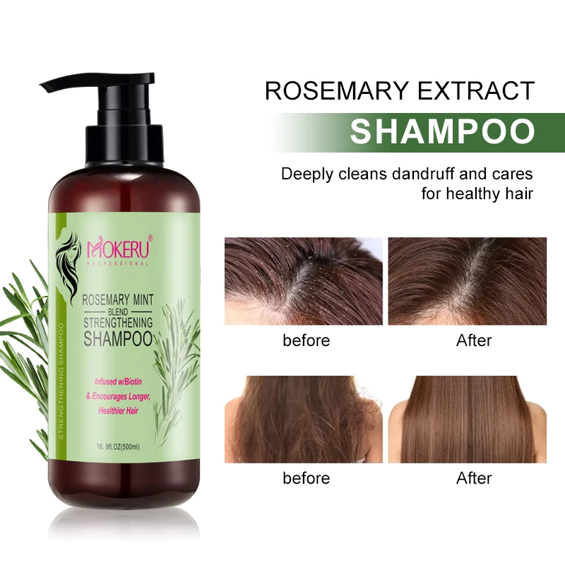 MOKERU Best hair shampoo rosemary seise conditioner rosemary growth oil natural shampoo and conditioner