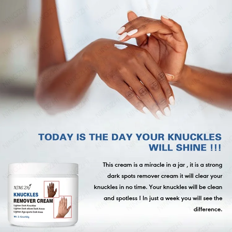 Hot sale best dark spot corrector cream lightening whitening dark knuckle elbows knees eraser cream