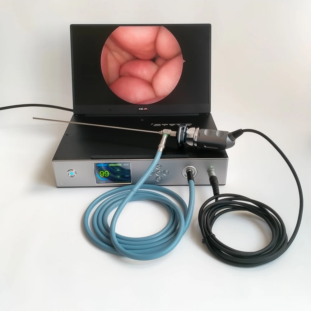 Camjoy CY2200 Portable 3 In 1 1080P 60Fps Full HD Endoscopy Endoscopic Camera with 100W Led Light source and 15.6 Inch Screen