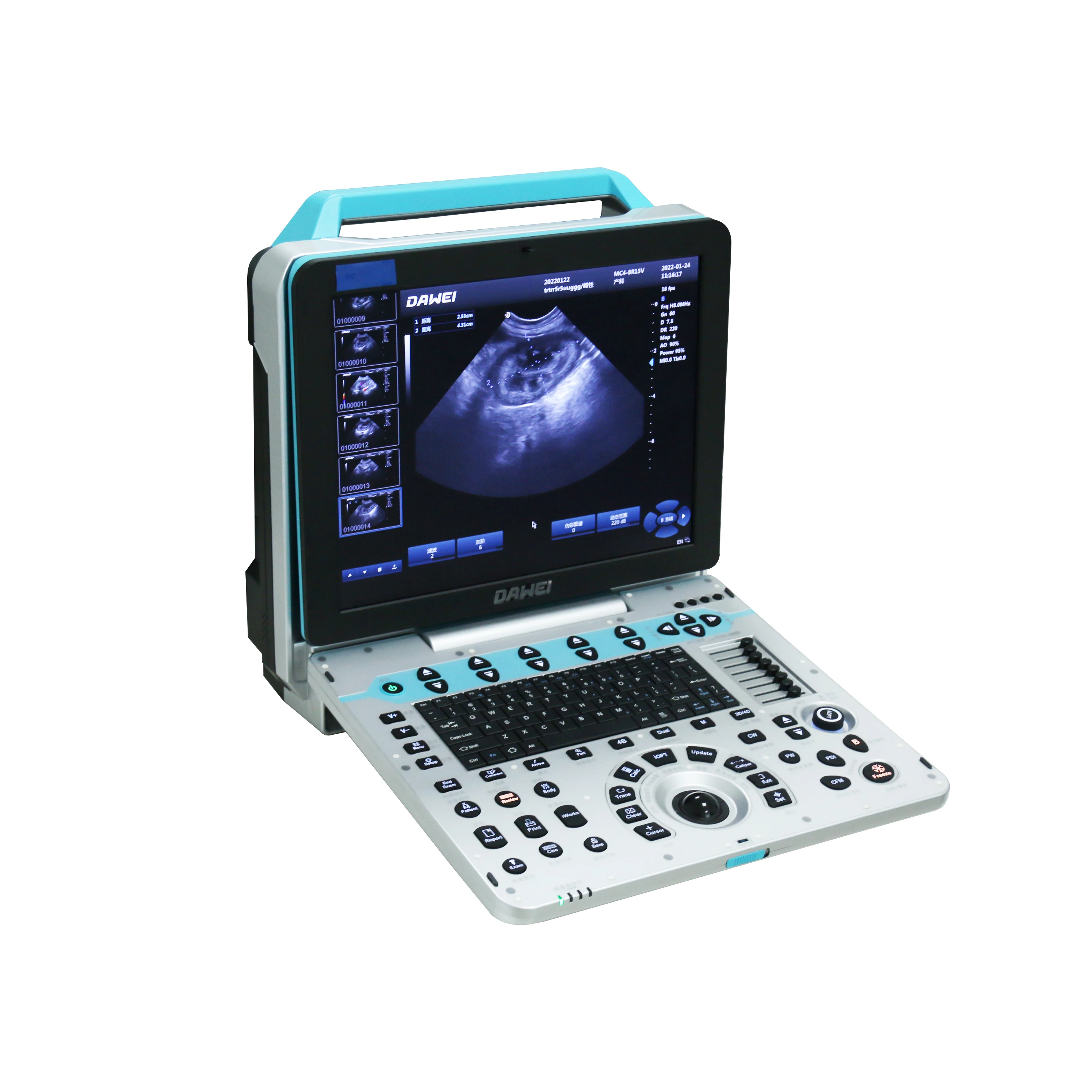 Dawei Vet Ultrasound Scanner Veterinary Digital Ultrasound Machine Companion Animal Color Doppler Ultrasound