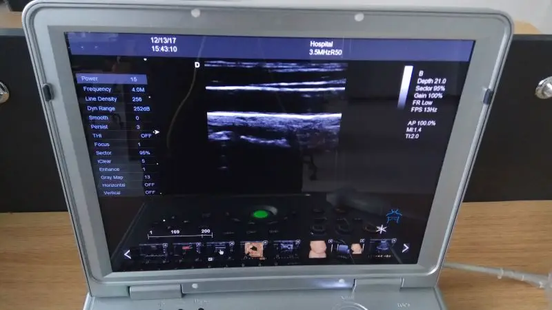 Usg machine 4d  3d ultrasound machine digital portable doppler ultrasound price