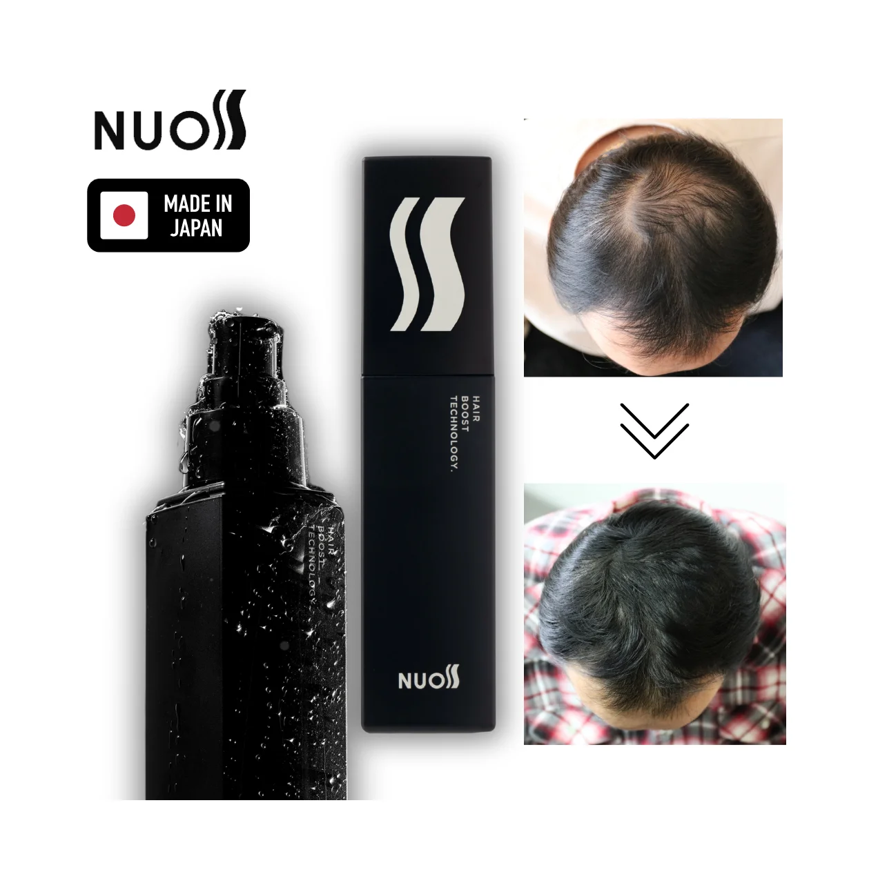 High Quality Salon New Shampoo Treatment Men Product For Hair Growth Best Selling