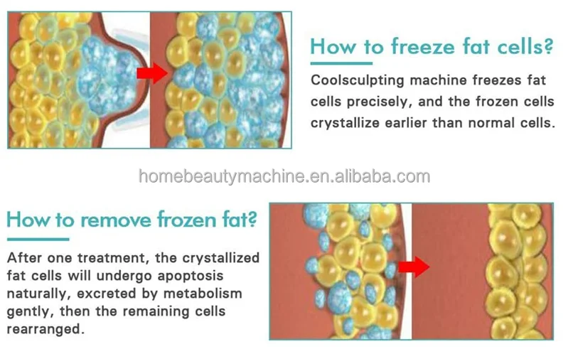 OEM New Second Generation Mini Portable Electric Cryotherapy Home Use Slimming Machine For Fat Lose