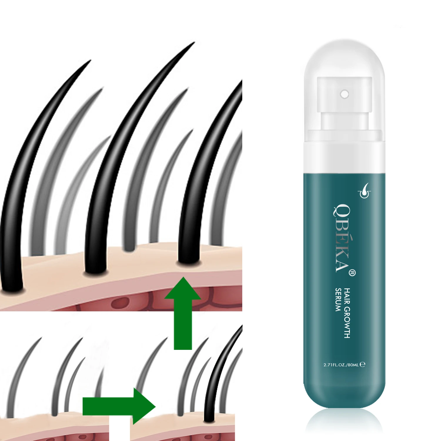 Anti Loss Serum Hair Growth Oil Alopecia Hair Loss for Enhance Hair Grows