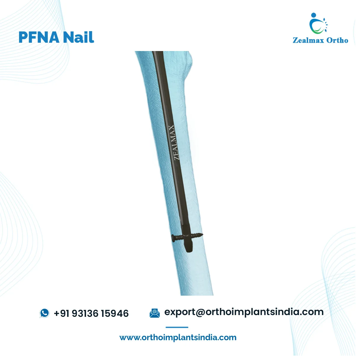 Zealmax Ortho Orthopedic Trauma Implants High Quality Pure Titanium Material PFNA Femoral Intramedullary Nail