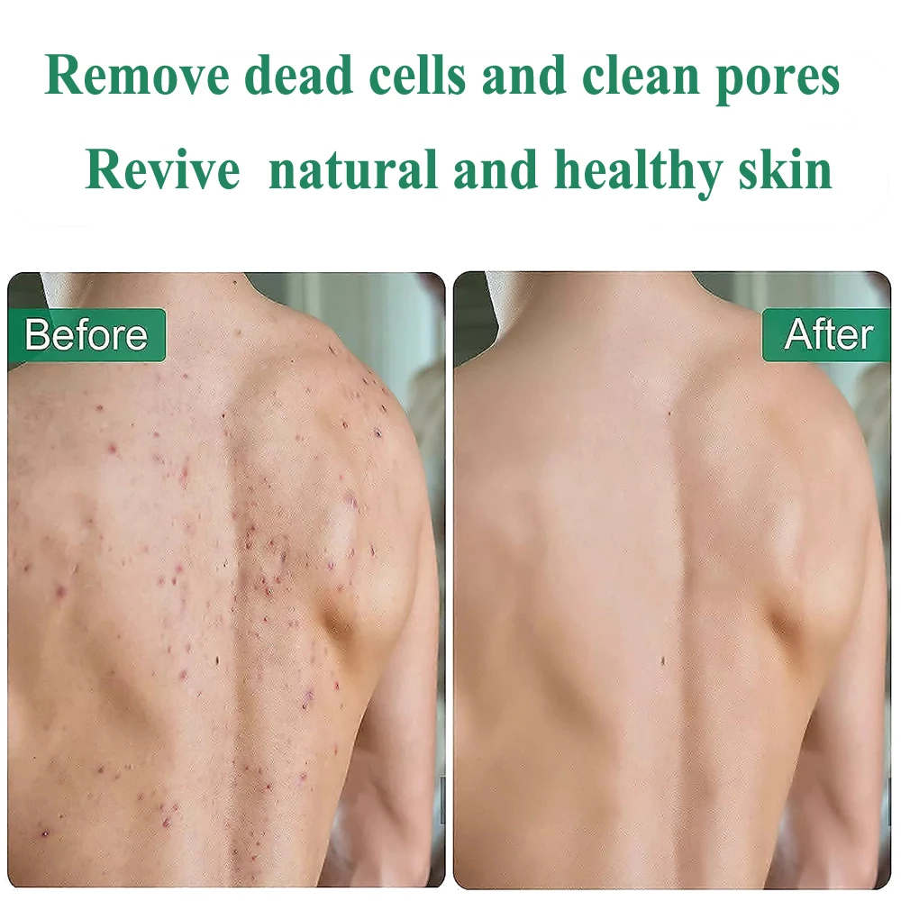 Luxury Custom Turkish Bath Glove Mitt Silk Exfoliating Glove Wash Shower Scrub Skin Massage Exfoliator