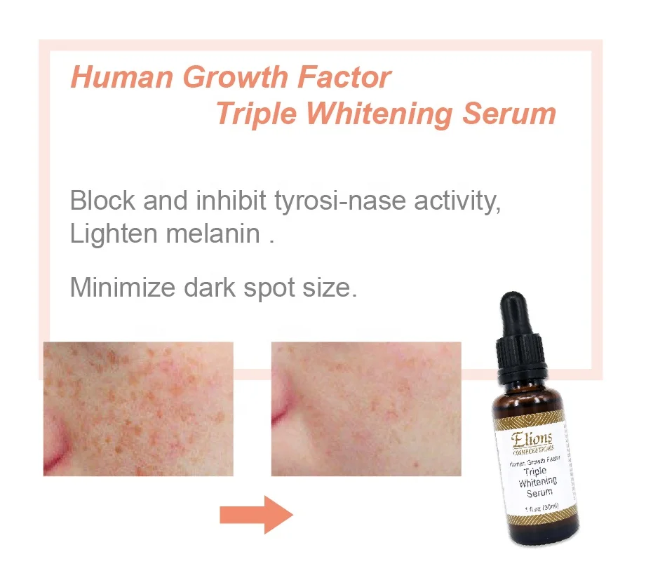 Minimize darkspot remove melanin alpha arbutin Nonapeptide-1 anti aging pigment whitening skin care serum