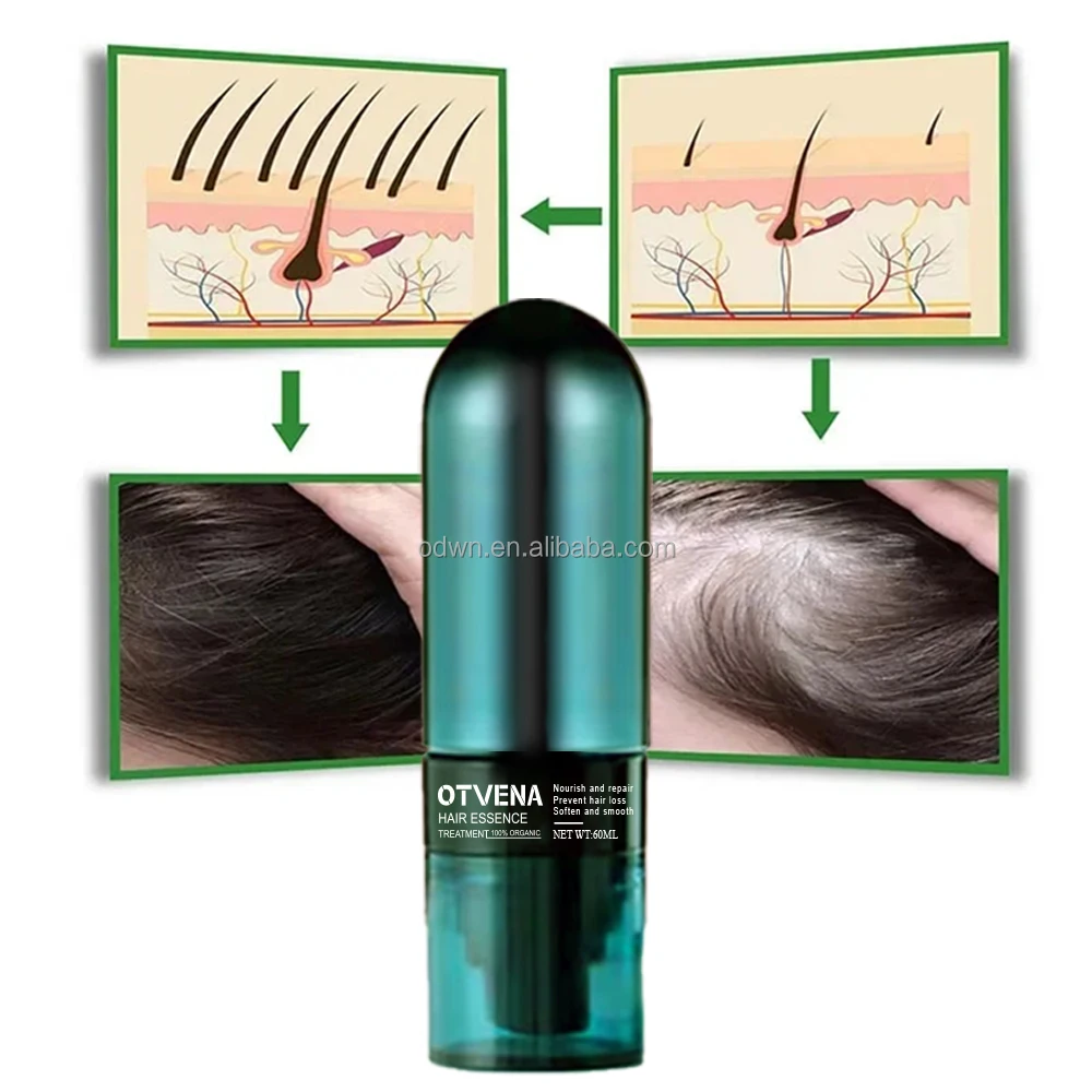 OTVENA good quality natural hair growth spray bottle hair smoothing conditioner spray