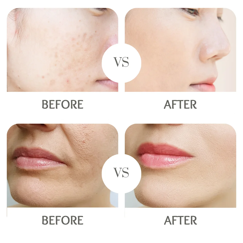 OEM ODM Flexible MOQ Customizable RenewCica Refining Serum for Skin Renewal and Hydration.