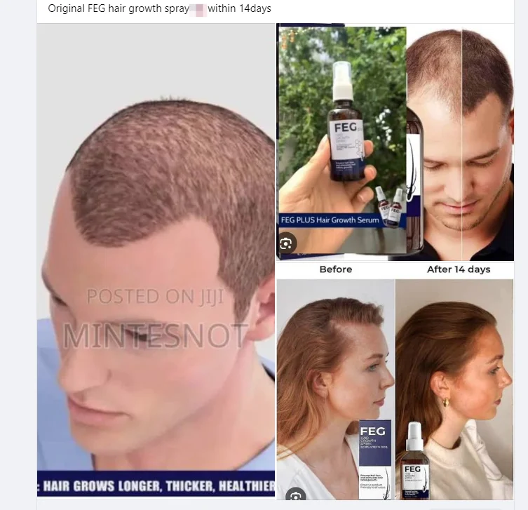 50ml FEG Hair Spray Anti-HAIR Loss Treatment Regrowth Oil Serum AMZ TK Hot Sale