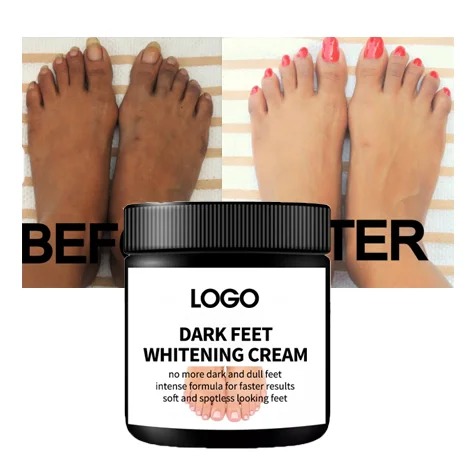 Brightening smoothing hand and foot whitening cream heel cracked dry repair dark knees and elbows dark feet whitening cream