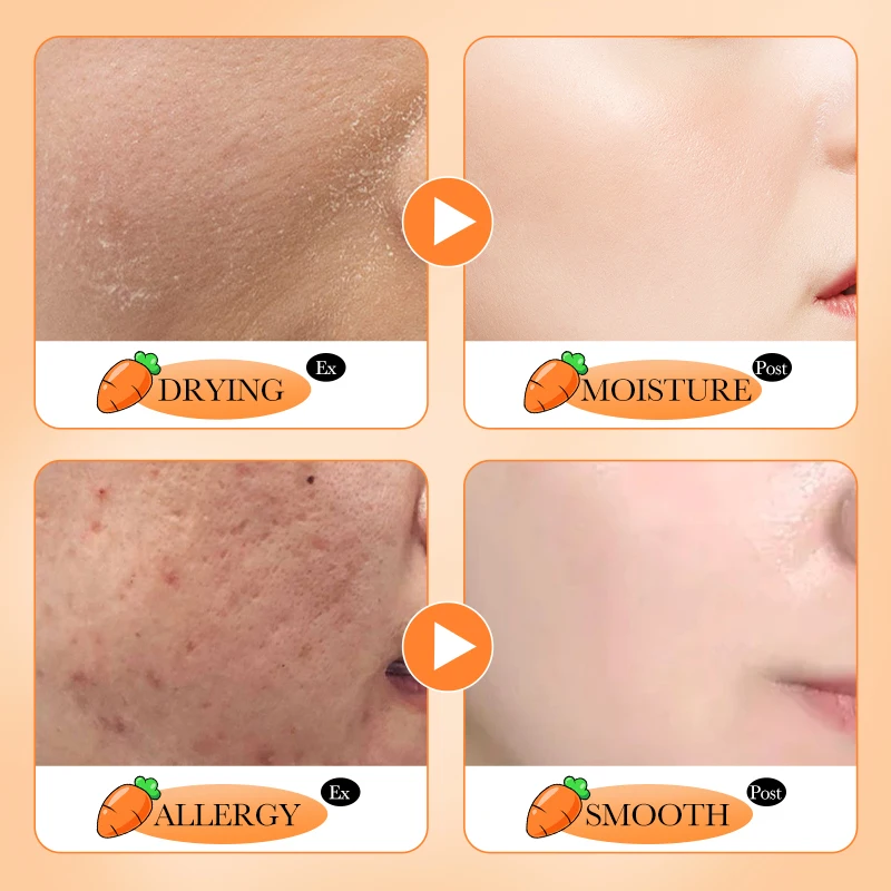 OEM SADOER private label B carrot herbal beauty products brightening anti aging face face skin care set