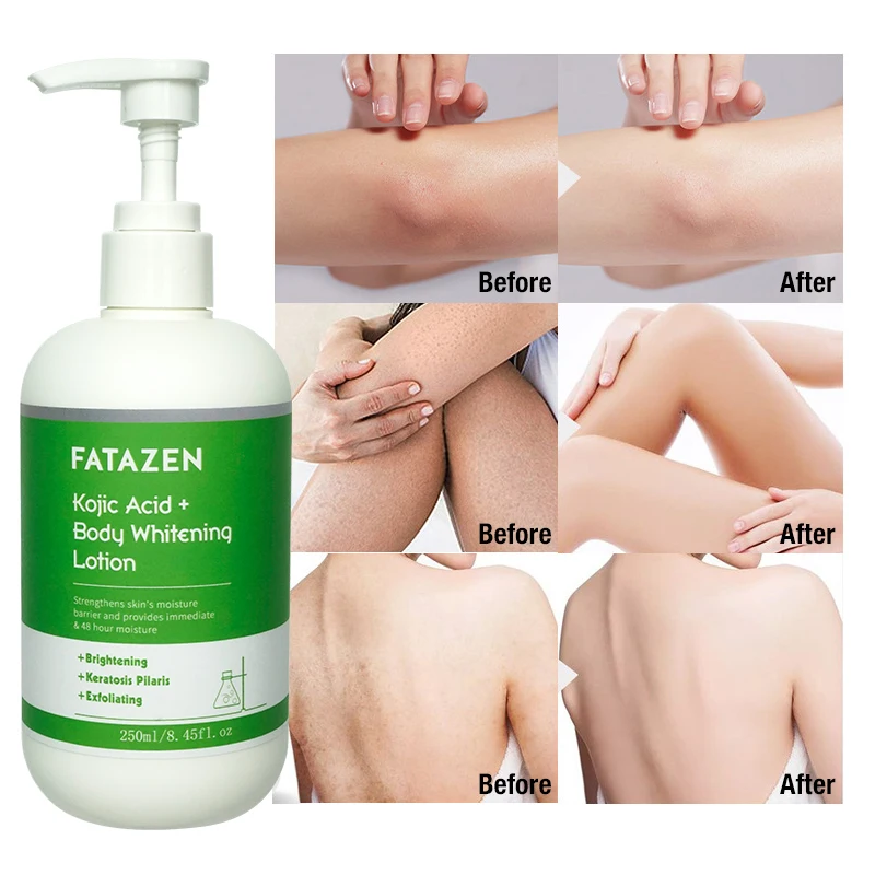 Private Label Organic Kojic Acid Whitening Lotion Body Repair Exfoliating Cream OEM Skin Care Moisturizing Body Whitening Lotion