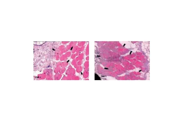 Bone Graft Granule Stick Block Quality Silicate Additive  Synthetic Osteoconductive Granule TCP  Osteoconductive Osteoinductive