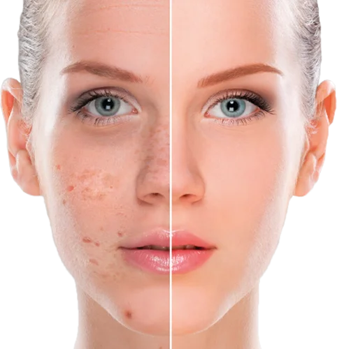 Meline Hydrating Toner for Dry, Dull, Sensitive Skin, Premium High-end Hydrating Anti Aging Serum Boosting Facial Essence