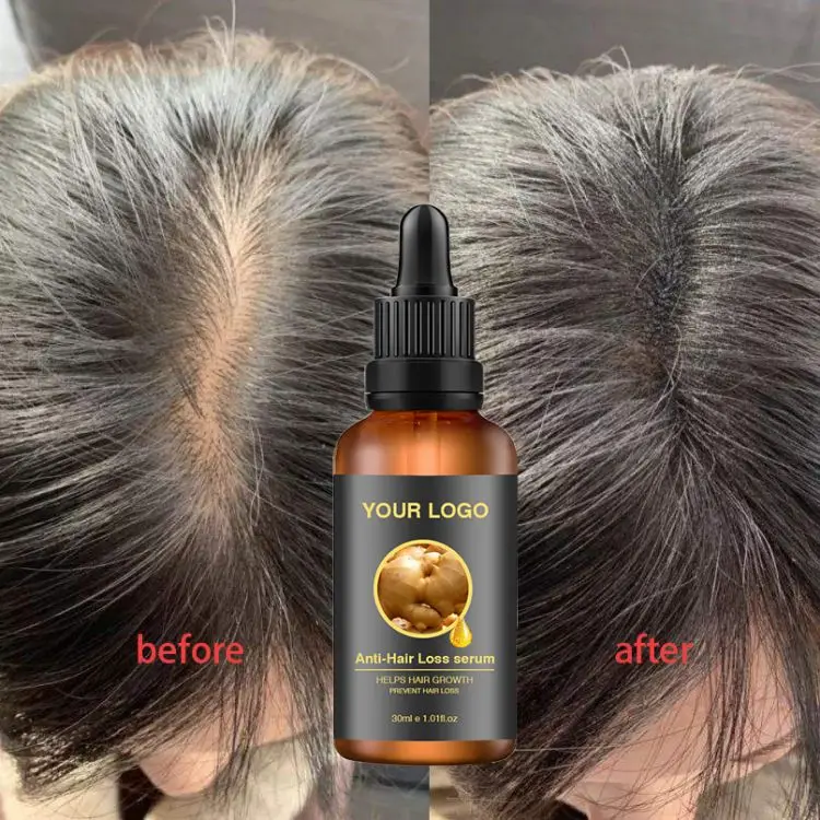 Private Label Best Natural Organic Biotin Hair Growth Serum Herbal Nourishing Essential Oil for Men and Women Use at Home