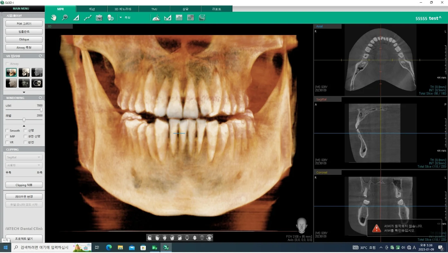 USED DIGITAL CT PANORAMIC DENTAL X-RAY SYSTEM w/wo CEPHALO UNIT