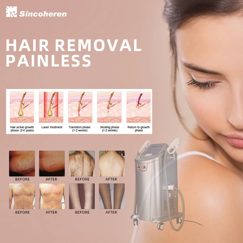 2023 hot selling IPL laser Hair Removal Device for skin rejuvenation and hair removal