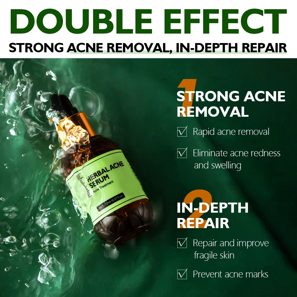 Acne Treatment Serum Private Label Acne Spot Serum Treatment Skin Care Acne Treatment Face Serum