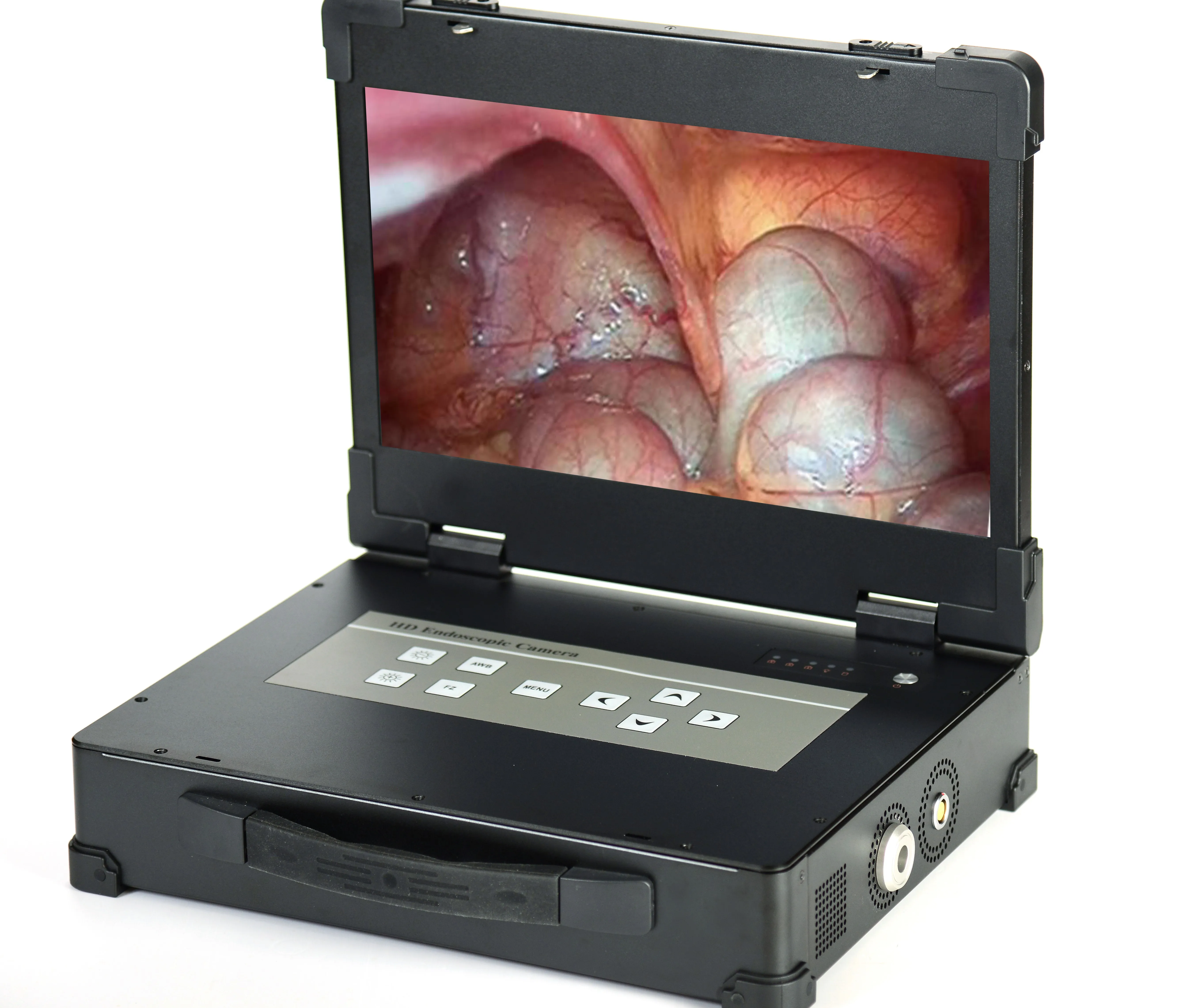 Surgical Instruments Basis Medical Endoscopy Camera System with Light SourceSIN-SED10