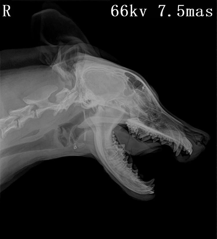 2024 Factory Price DR 17*17 inch Multi Languages Wireless Flat Panel Detector With Manual Stitching Function