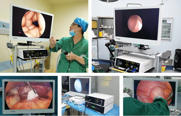 IKEDA YKD-8132H 4K Medical Monitor 4K resolution Surgical Display , wider color gamut