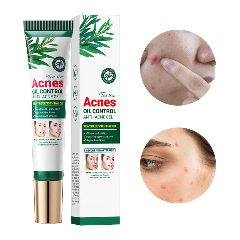 Wholesale  Oil Control Shrink Pores Tea plant fades acne marks effectively removes acne reduce  anti acne face cream