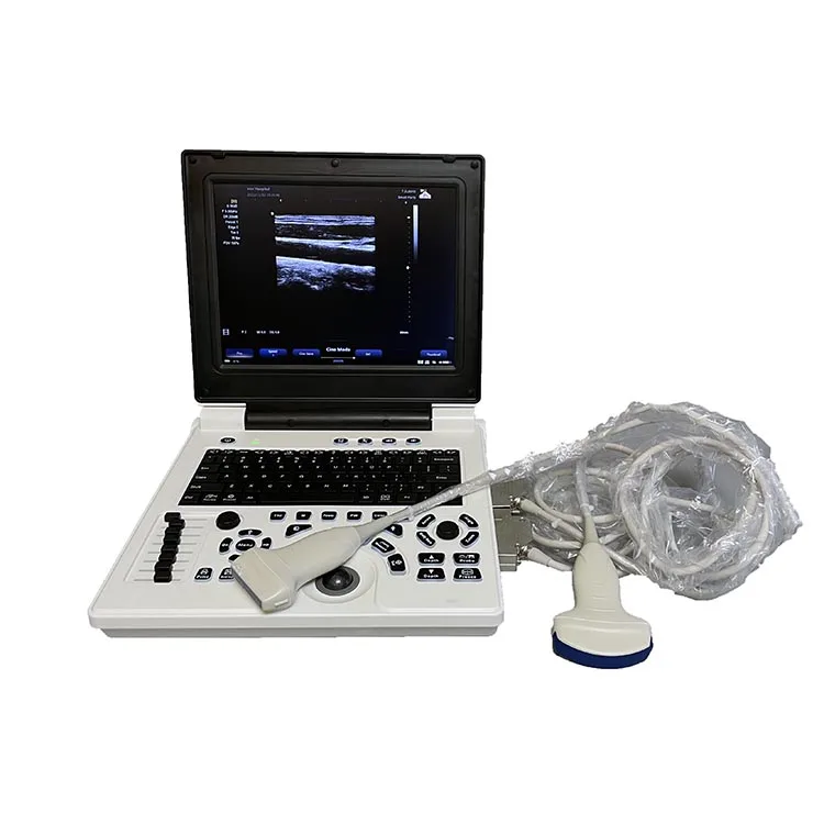 Cheapest 3D Laptop Color Doppler Ultrasound Diagnostic System  Machine for Hospital
