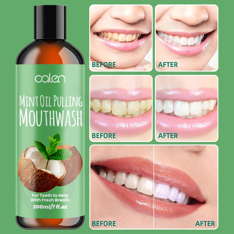 Oalen Customs Logo 200ML Teeth Whitening Support Healthy Gums Pulling Oil Mouthwash For Oral Care