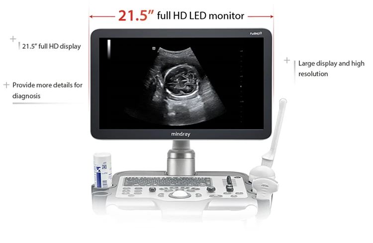 2023 Mindray DC-30 Ultrasound System 3D 4D Trolley Color Doppler Machine With 21.5 Inches Full HD LED Monitor