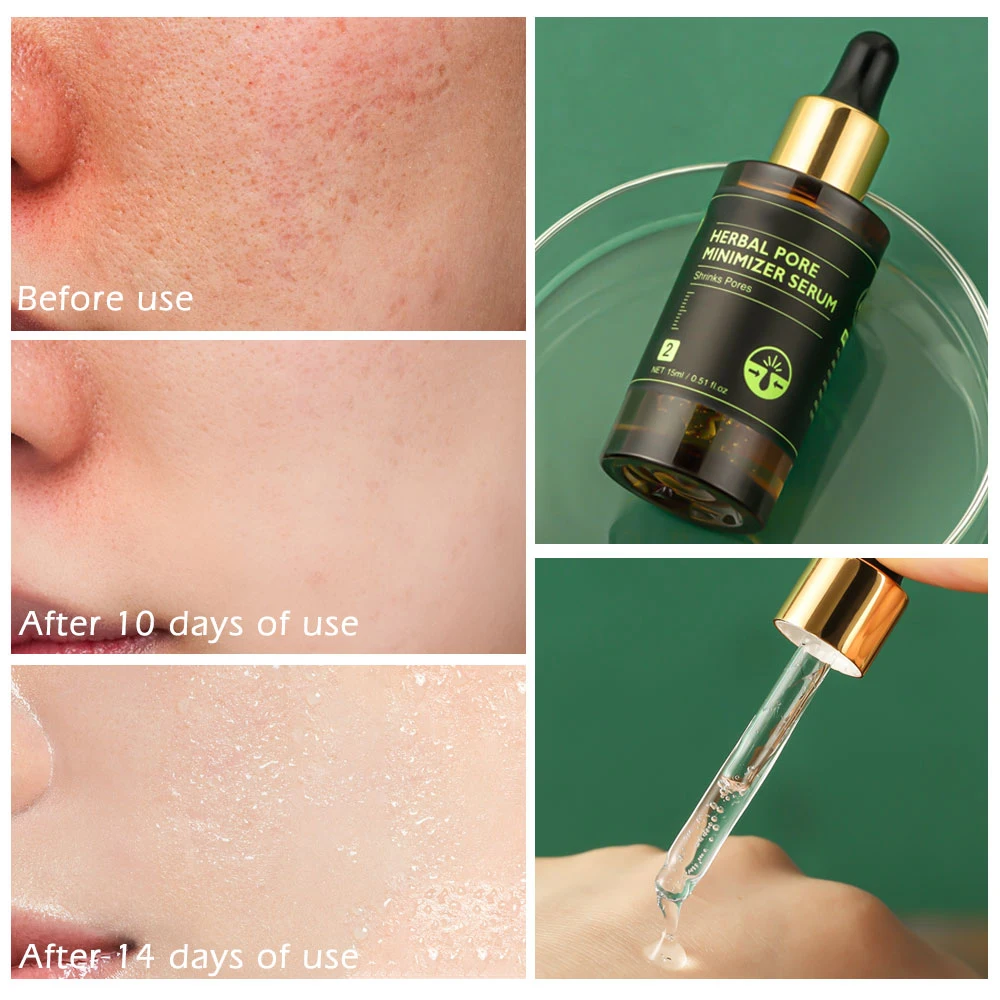 Stock Hot Sale Tea Tree Oil Face Serum Nose Pore Refining Tightening Skin Pores Minimizer Serum