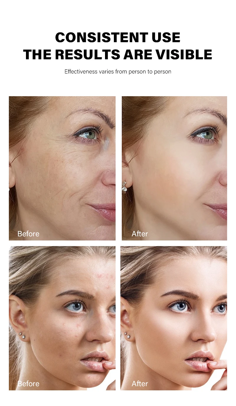 Private Label Vegan Organic Skin Anti Aging Wrinkle Lightening Whitening Collagen Elastin Face Cream For Face Black Skin