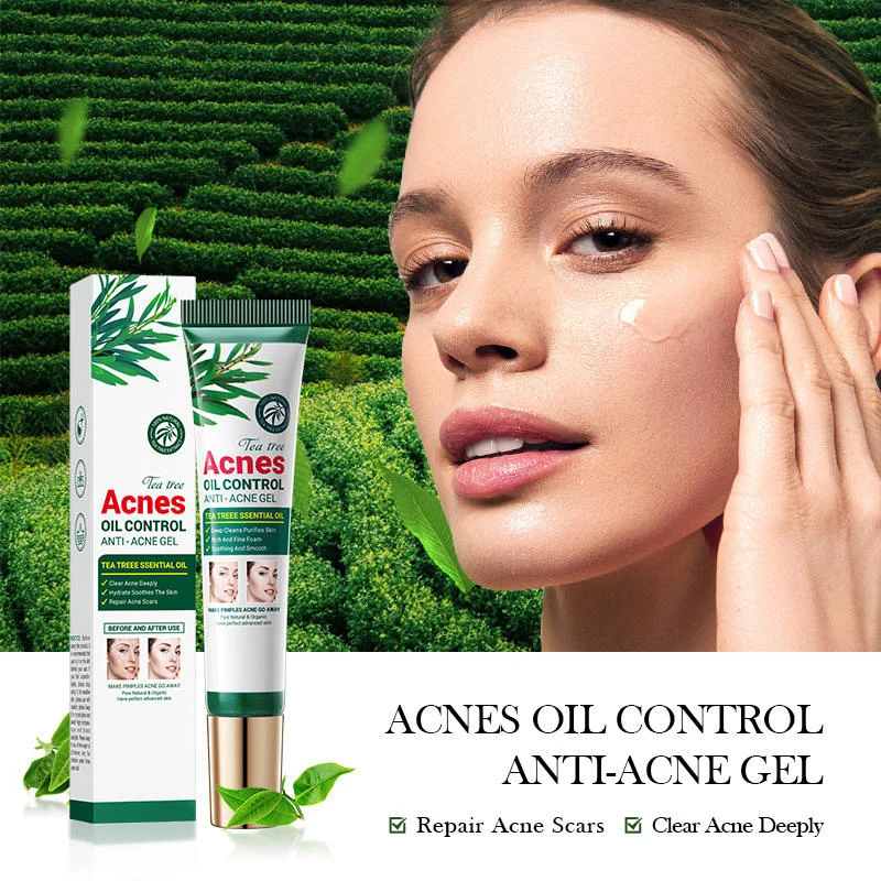 Wholesale  Oil Control Shrink Pores Tea plant fades acne marks effectively removes acne reduce  anti acne face cream
