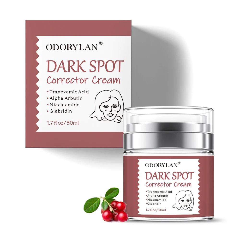 wholesale whitening pimples acne scar treatment freckle dark spot corrector removing fade cream