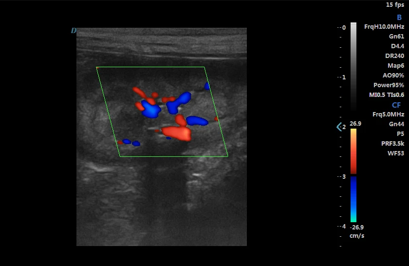 Dawei Tissue Doppler Imaging THI TDI Veterinary Color Doppler Ultrasonic System
