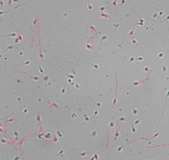 Sperm Analyzer Automatic Semen Analyzer Sperm concentration rapid test,increase sperm count