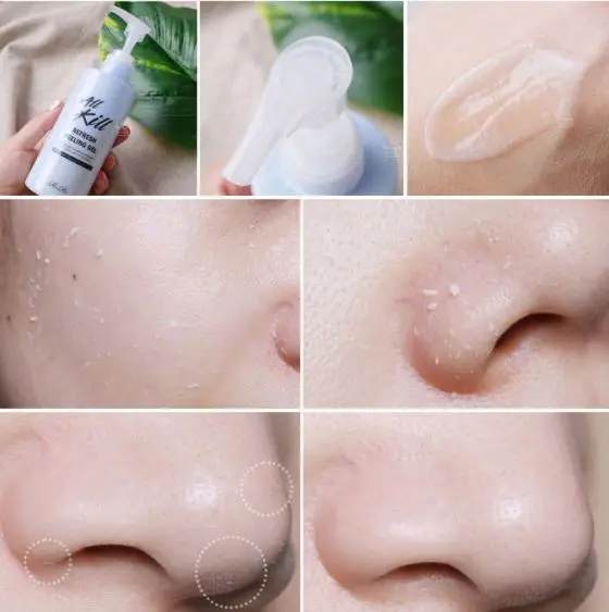 [Korea Cosmetics]All kill refresh peeling gel hypoallergenic exfoliate face peeling gel Moisture retention and brightening
