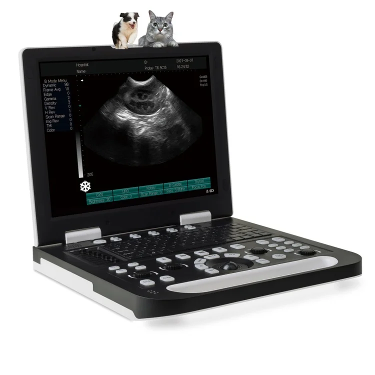 Portable ultrasound scanner N50 ultrasonography machines medical ultrasound imaging
