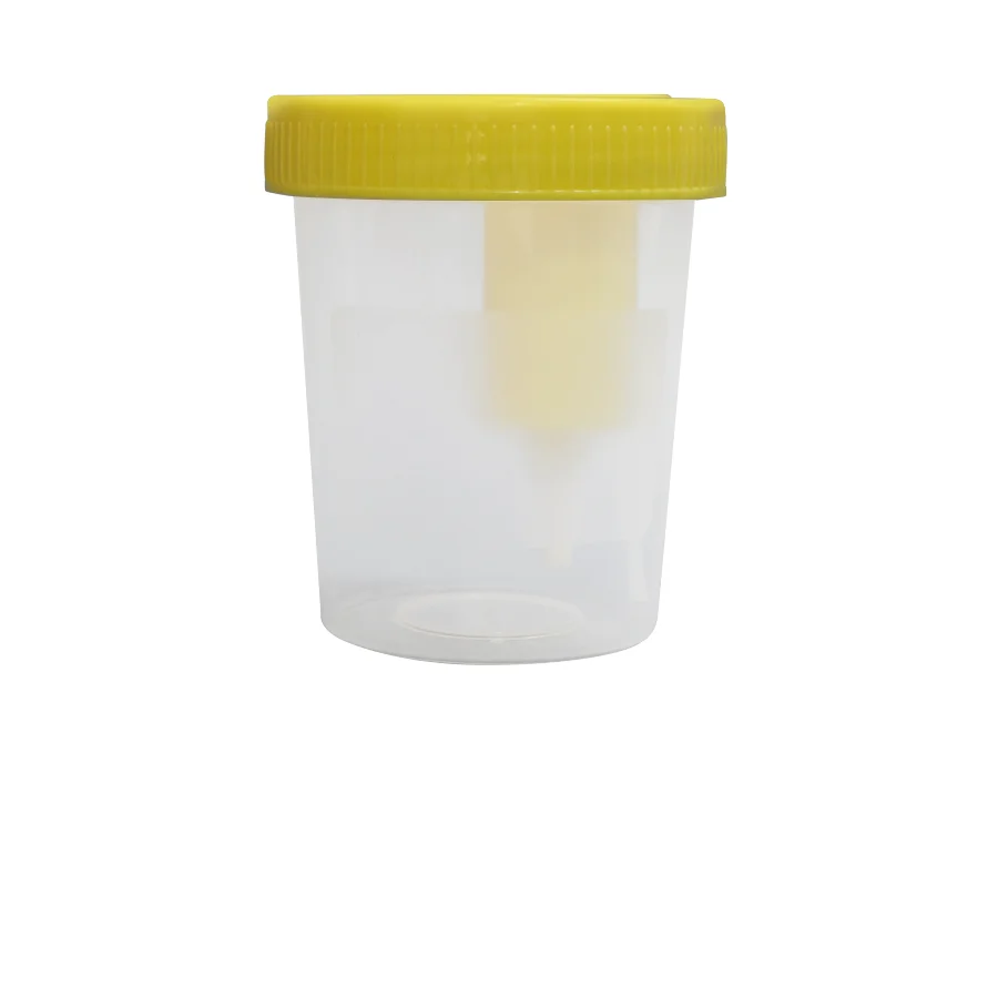 Vietnam plastic urine specimen collection with lid sterile OEM - delivery quickly free tariff- M0271