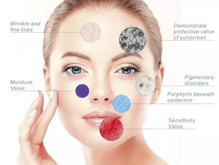 2022 New Product Portable Hot Sale RGB, UV, PL 3 Spectrum Magic Mirror 3D Skin Analyzer