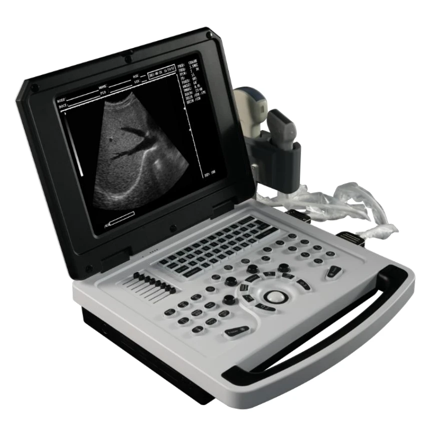 cheap medical ultrasound instruments white& black ultrasound  machine ultrasonido ecografo portatil ultrasound scanner